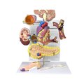 Gpi Anatomical Anatomical Model - Diabetes - Type 2 4010